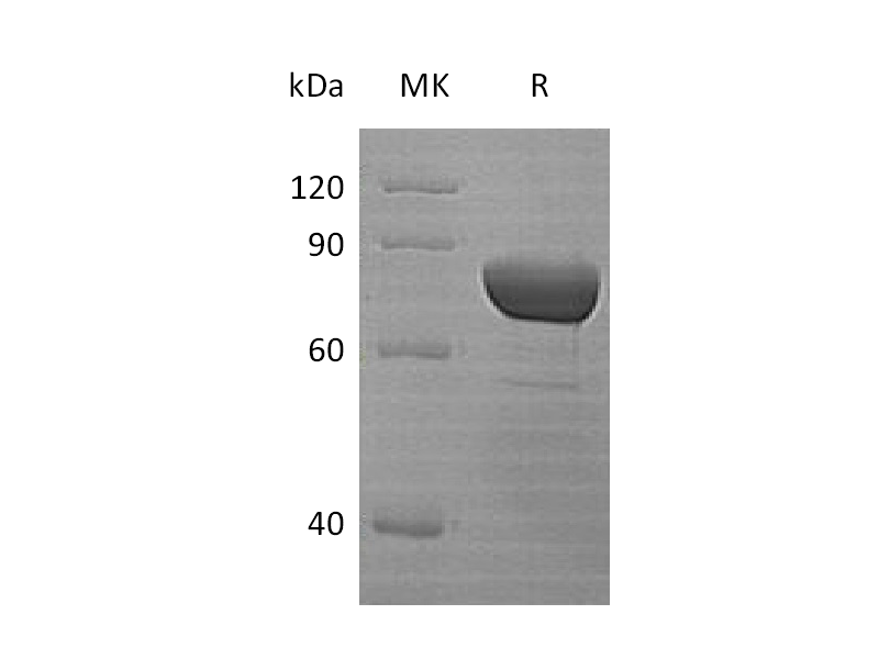 Recombinant Human DPP3 (N-6His)
