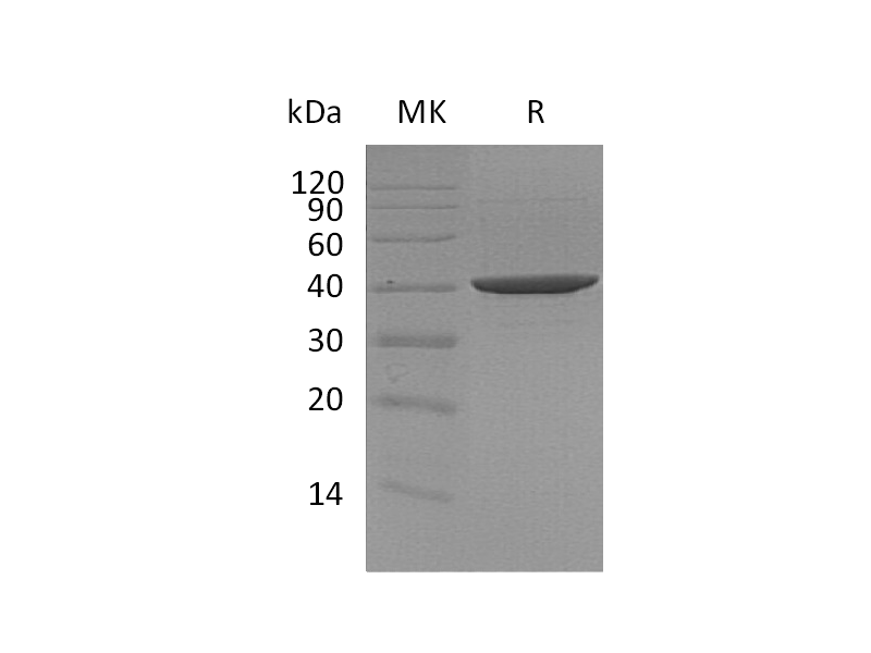 Recombinant Human DNA PolymeraseBeta (C-6His)