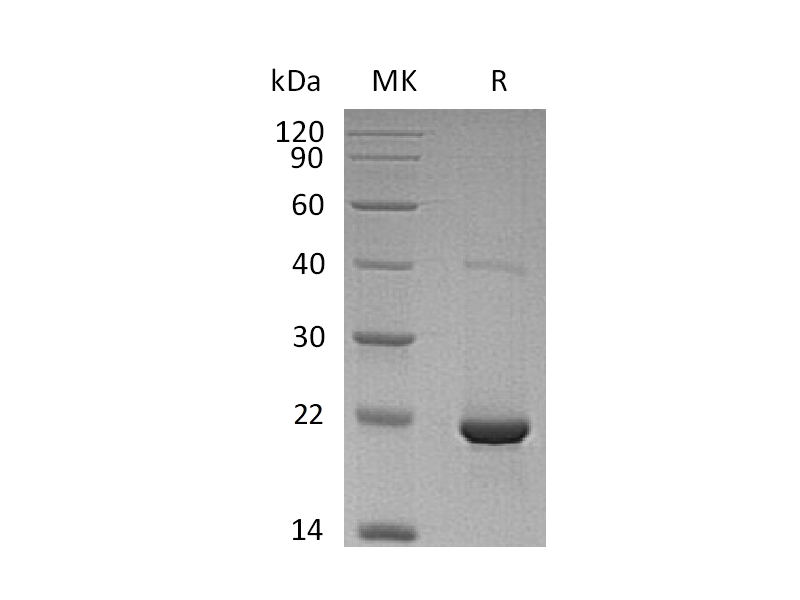 Recombinant Human dUTPase (N-6His)