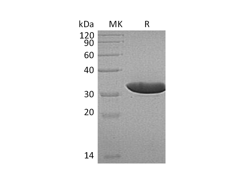 Recombinant Human ECH1 (N-6His)