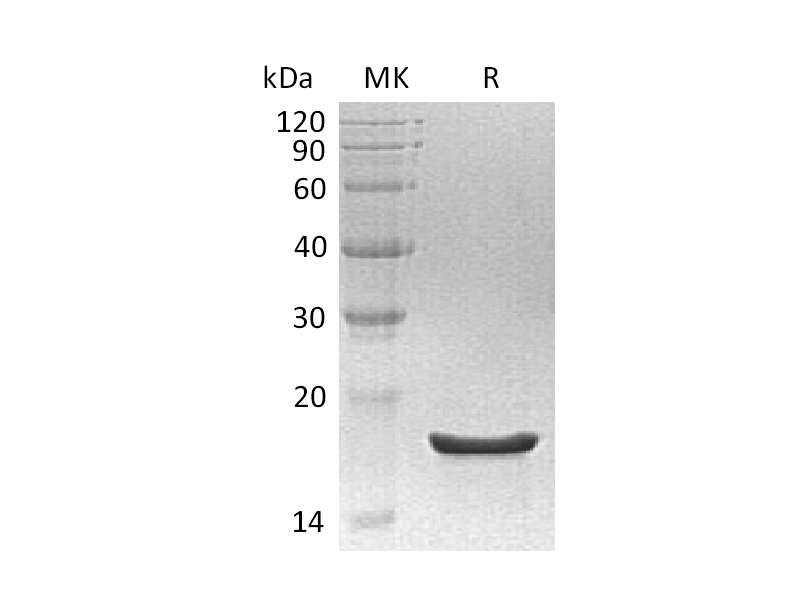 Recombinant Human EDF1 (C-6His)