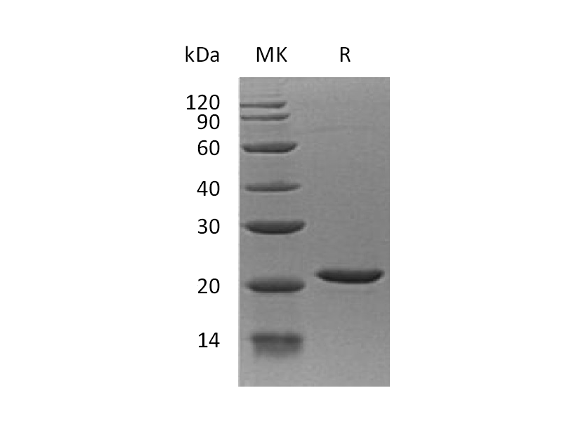 Recombinant Human EIF1AX (N-6His)