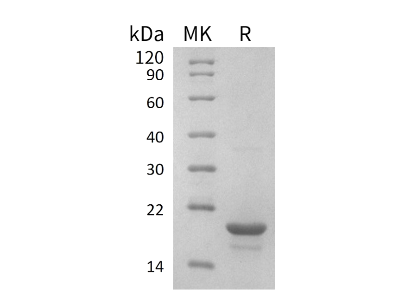 Recombinant Human EIF4EBP1 (N-6His)