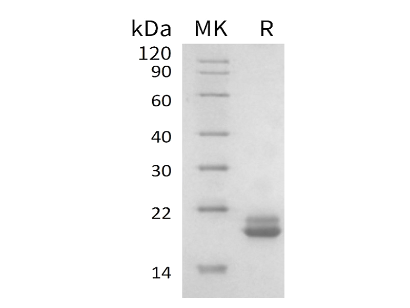 Recombinant Human EIF4EBP2 (N-6His)