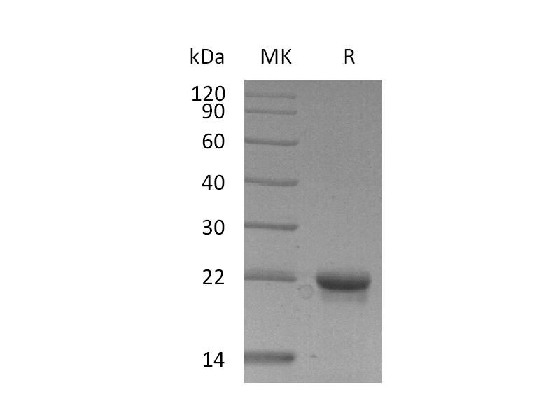 Recombinant Human EIF5A2 (N-6His)