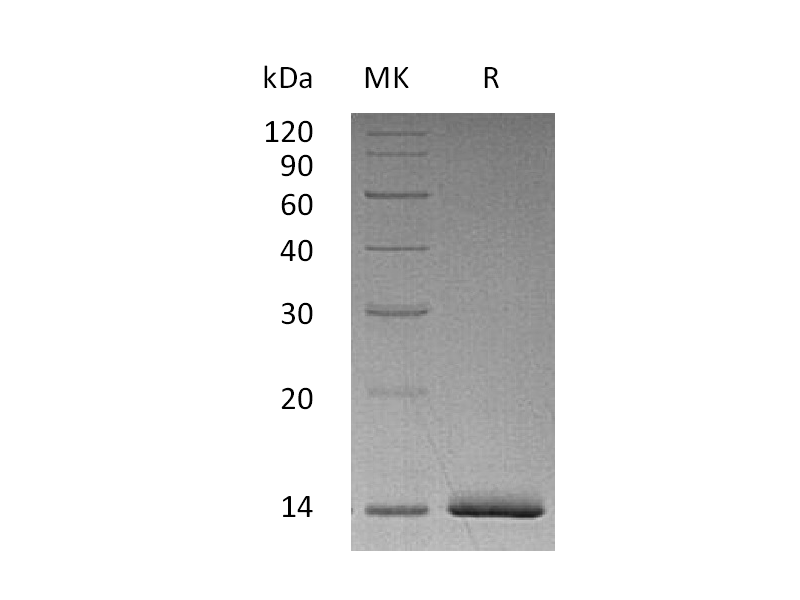 Recombinant Human ER alpha (N-6His)