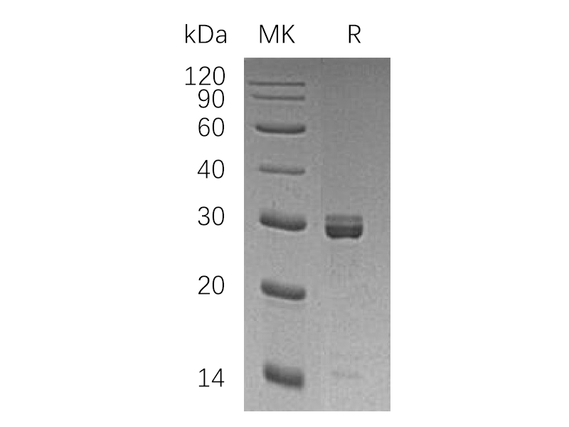 Recombinant Human EPT1 (N-GST)