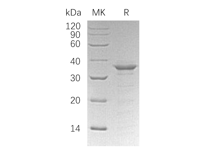 Recombinant Human ETS1 (N-6His)