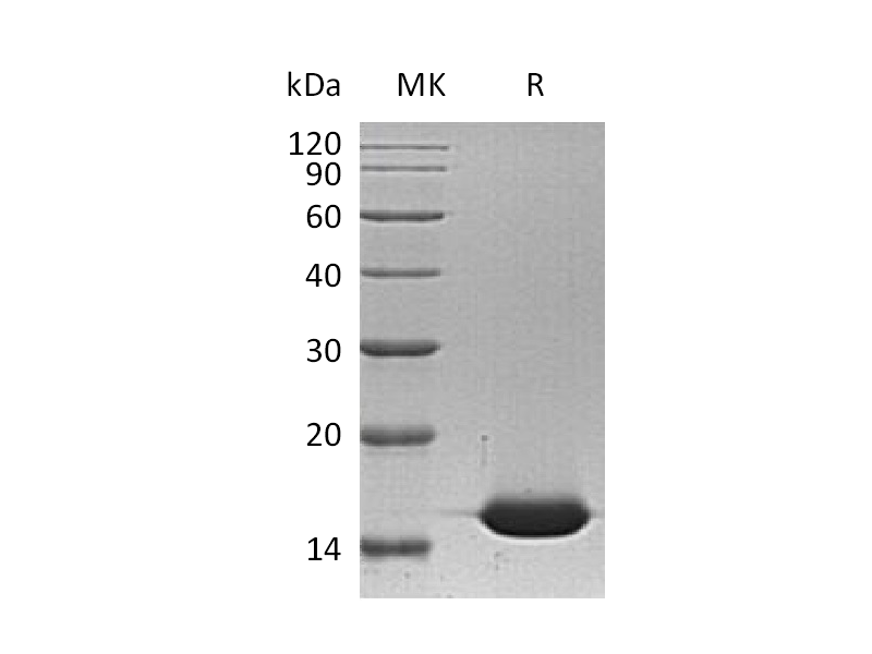Recombinant Human FABP1 (N-6His)