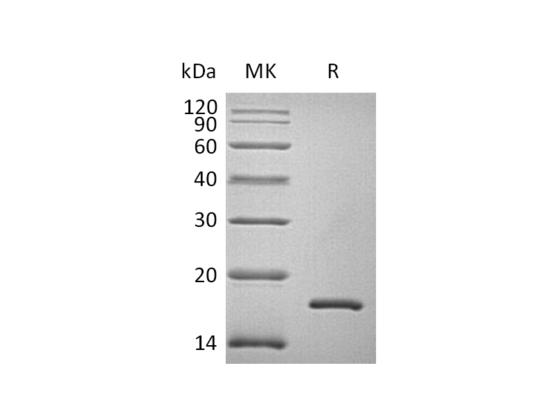 Recombinant Human FABP2 (N, C-6His)