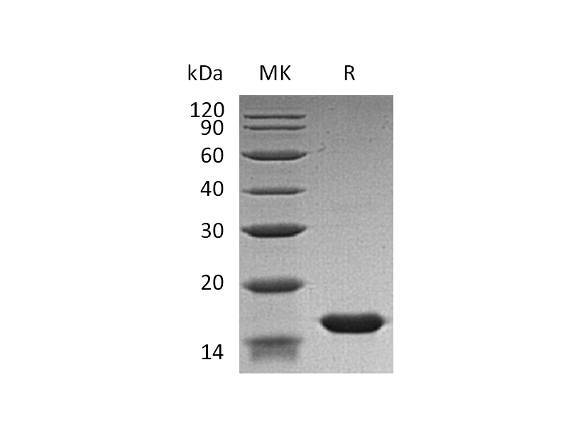 Recombinant Human FABP3 (N-6His)