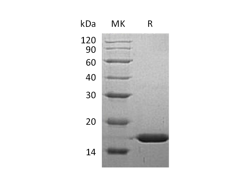 Recombinant Human FABP5 (N-6His)