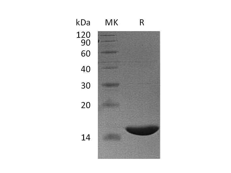 Recombinant Human FABP6 (N-6His)