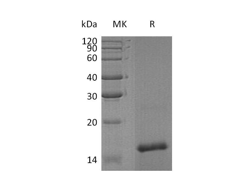 Recombinant Human TAFA4 (N-6His)