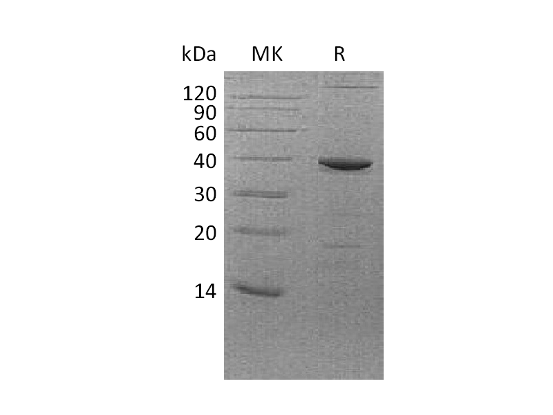 Recombinant Human FBPase1 (C-6His,E. coli)