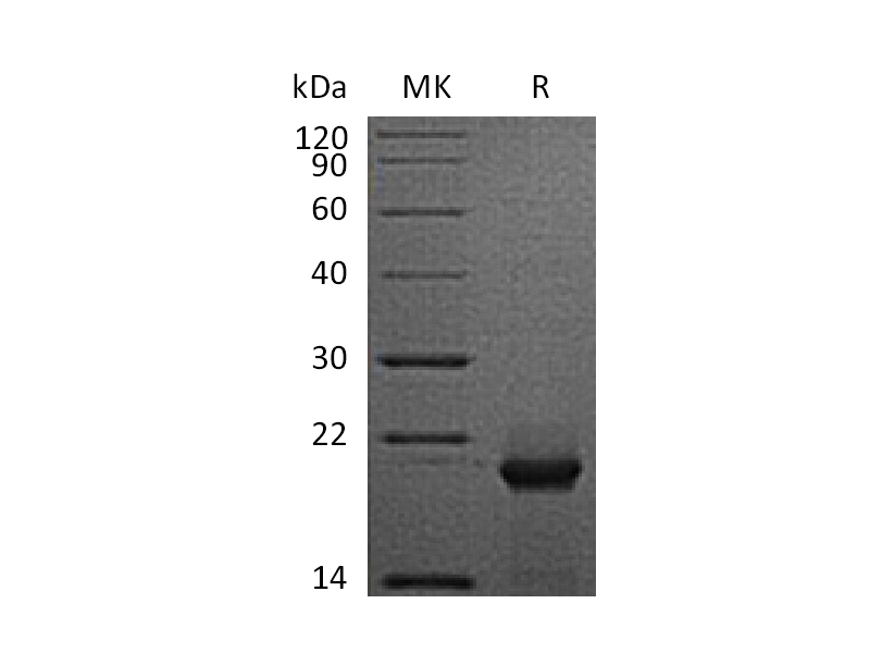 Recombinant Human FTH