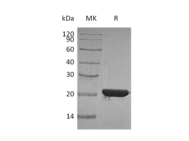 Recombinant Human FTH (N-6His)
