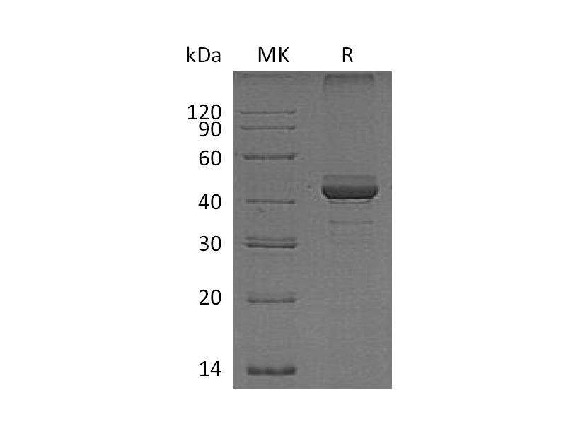 Recombinant Human FIBP