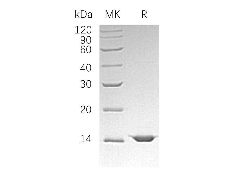 Recombinant Human FIS1 (C-6His)