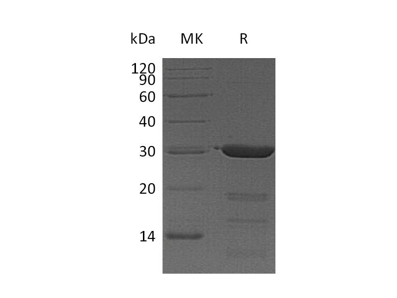 Recombinant Human FKBP3 (N-6His)