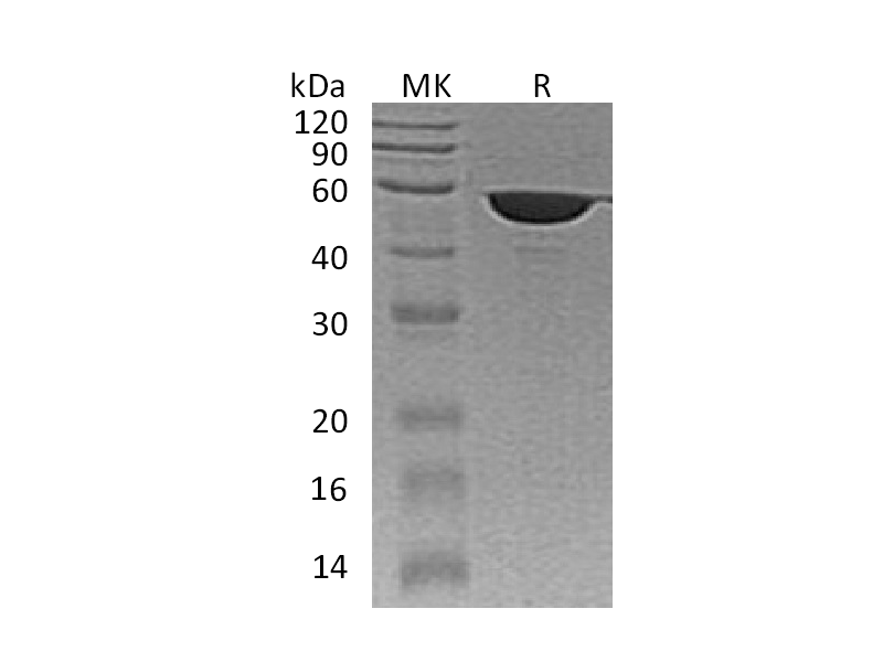 Recombinant Human FKBP4 (C-6His)