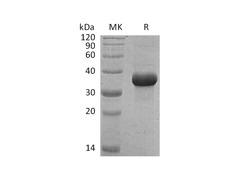 Recombinant Human FSTL1 (C-6His)