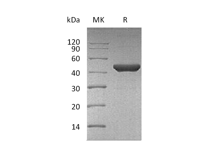 Recombinant Human Fumarase
