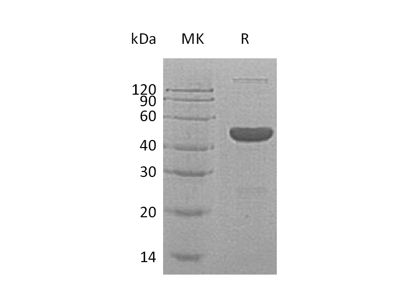 Recombinant Human GABARAP (N-6His, C-Fc)
