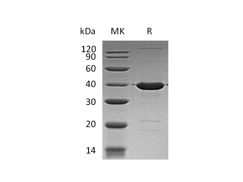 Recombinant Human GABARAP (N-GST)