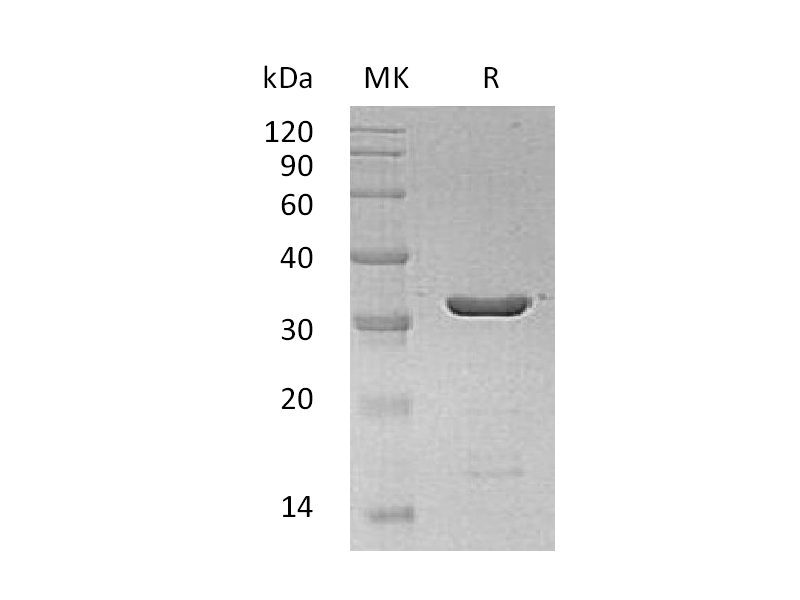 Recombinant Human LGALS8