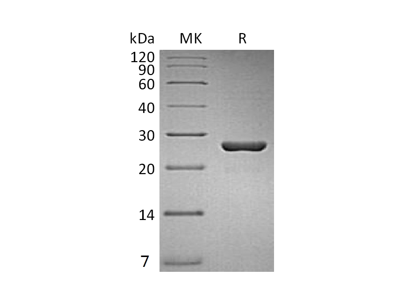 Recombinant Human Gankyrin