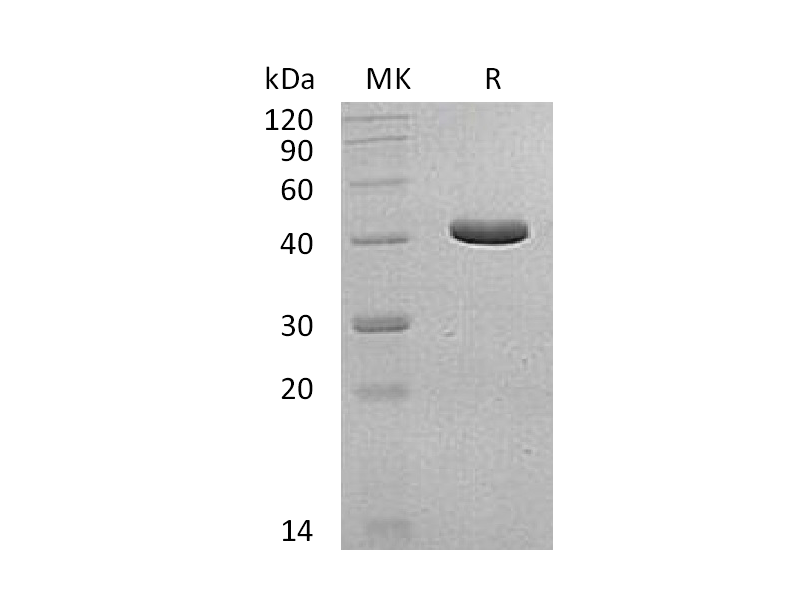 Recombinant Human GCDH (N-6His)