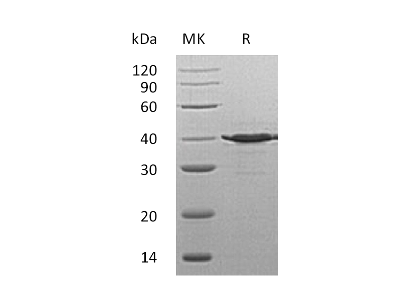 Recombinant Human TSTA3 (C-6His)