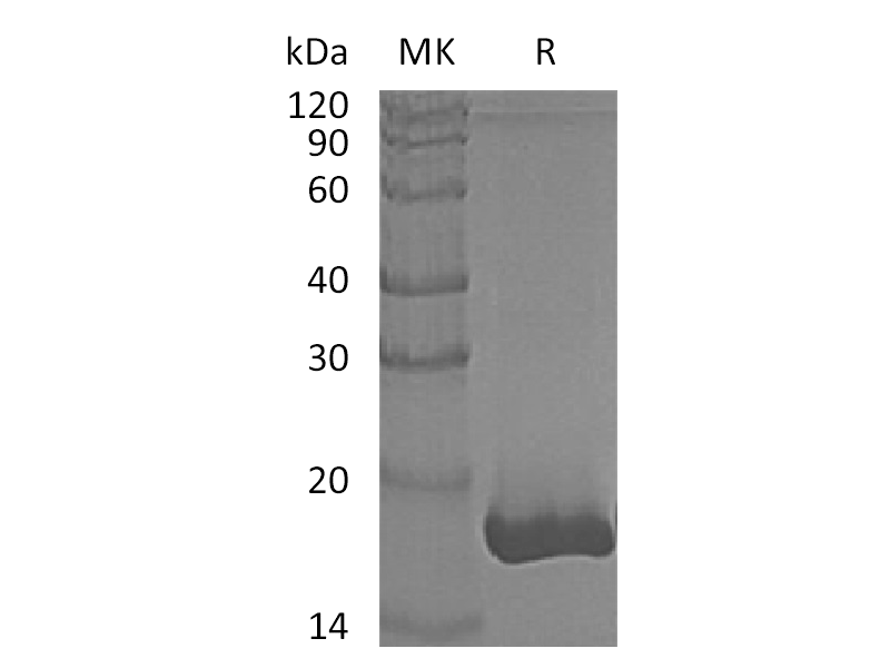 Recombinant Human GMFB (C-6His)