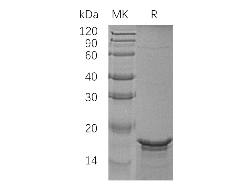 Recombinant Human GFAP (N-6His)