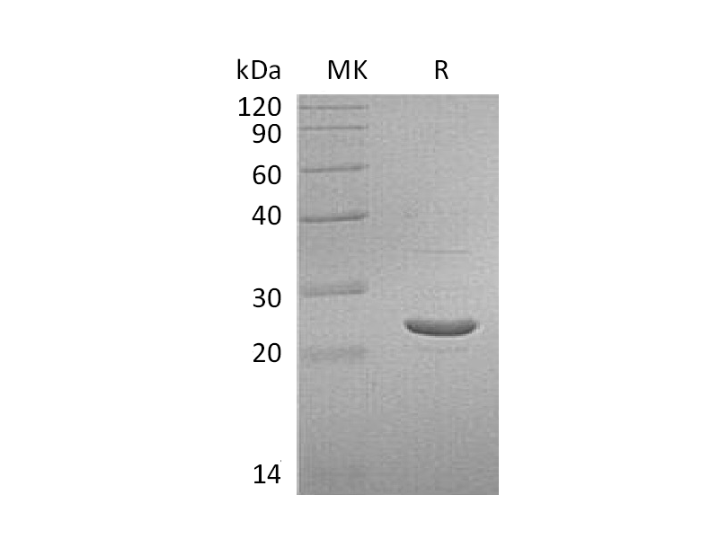 Recombinant Human GSTP1