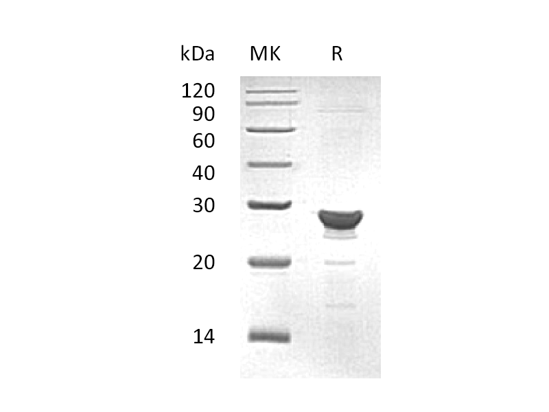Recombinant Human GSTZ1 (C-6His)