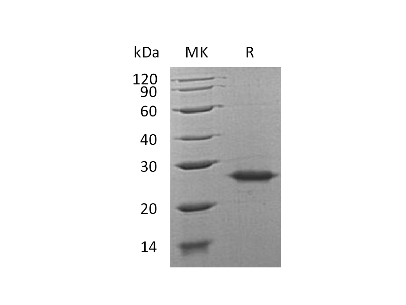 Recombinant Human Grancalcin