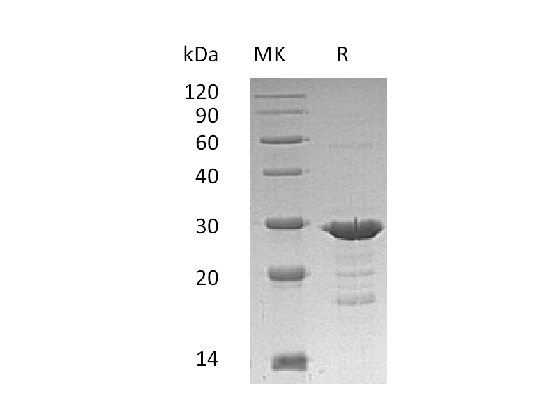 Recombinant Human GRB2 (C-6His)