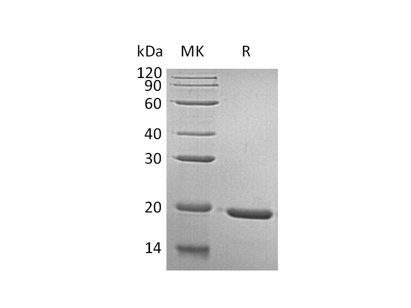 Recombinant Human GH