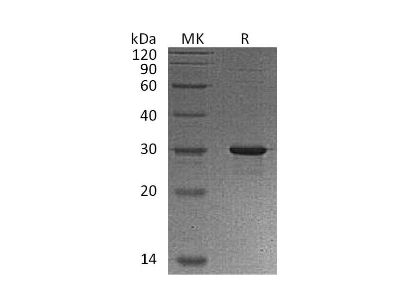 Recombinant Human GAMT (N, C-6His)