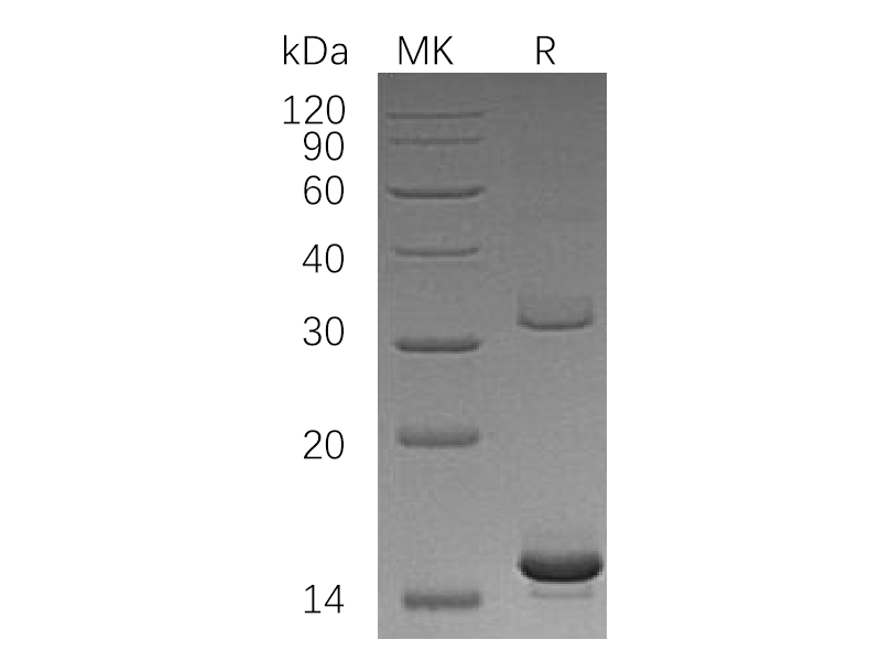 Recombinant Human HBAZ (N-6His)