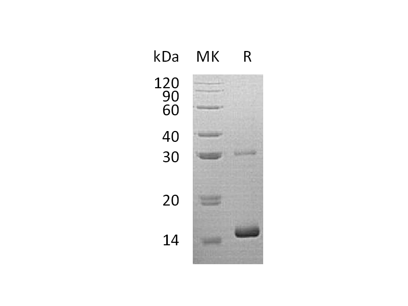 Recombinant Human HBQ1 (N-6His)
