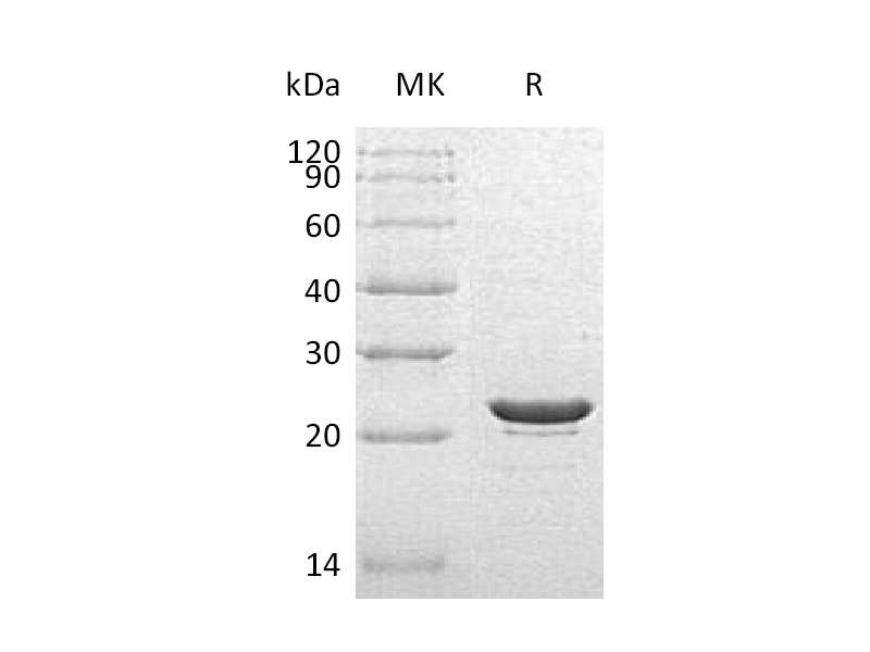 Recombinant Human HSPB8 (C-6His)