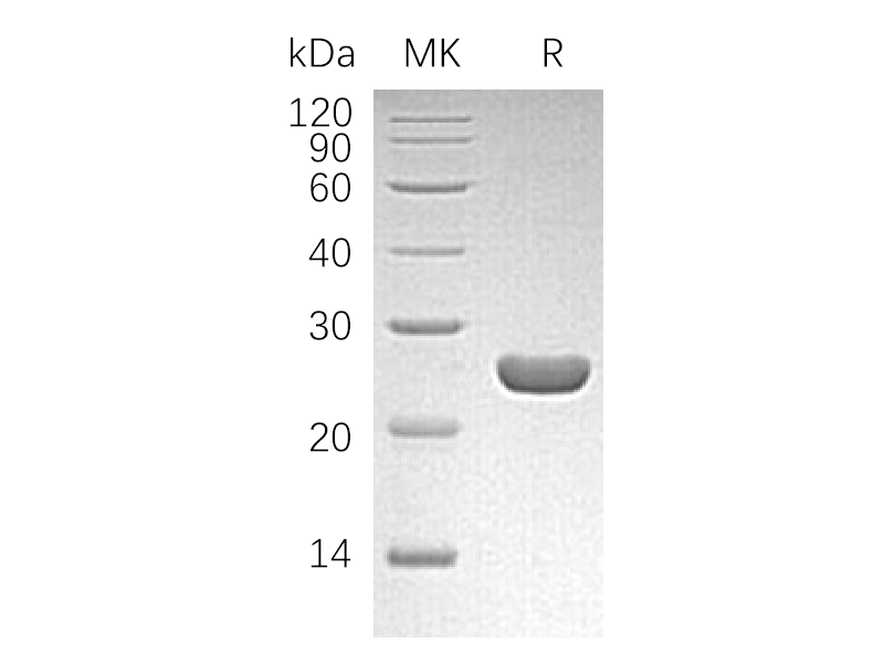 Recombinant Human PGDS