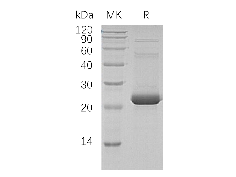 Recombinant Human ASF1A (C-6His, N-T7 tag)