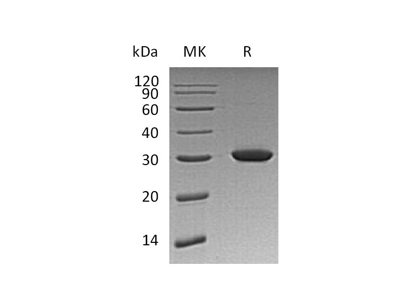 Recombinant Human HO-1