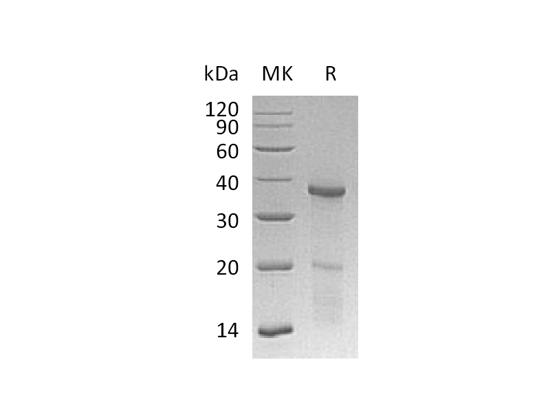 Recombinant Human HOXB4 (L175D, E176K, E178K, N-6His)