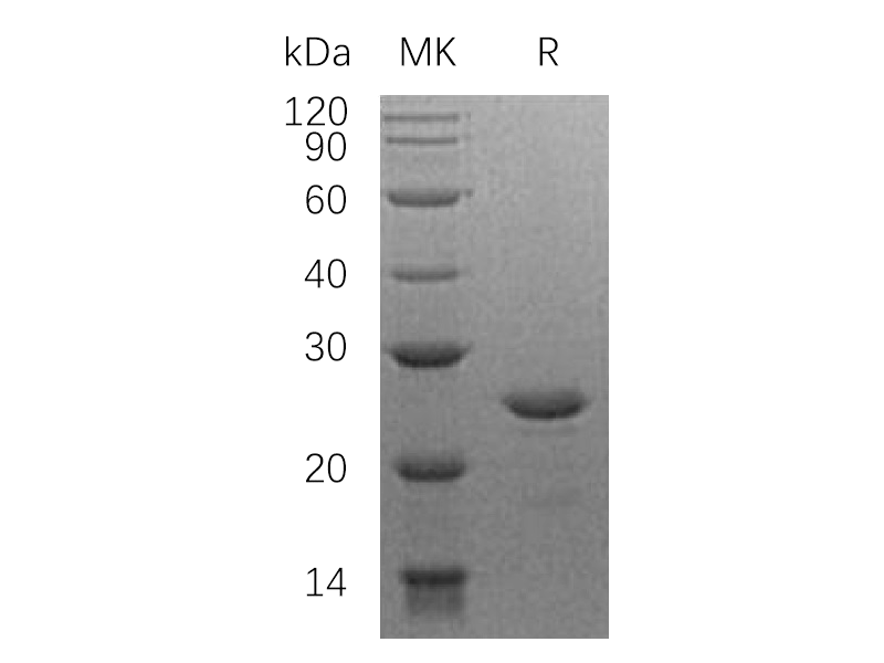 Recombinant Human HSF2 (N-6His)