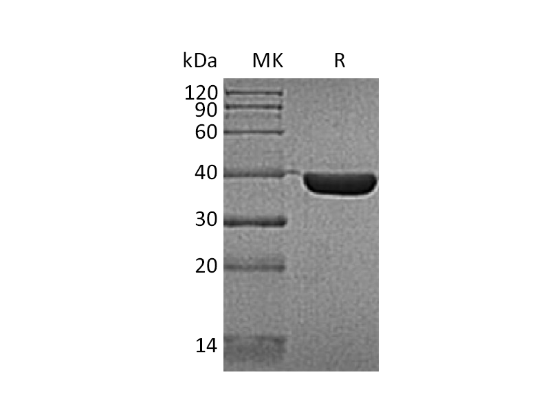 Recombinant Human HSP40 (C-6His)
